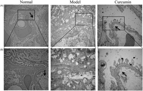 Figure 3. Effect of curcumin on autophagic vacuoles in renal tissues of DN-induced rats. Autophagic vacuoles in renal tissues were observed (black arrow) and photographed by transmission electron microscopy (bar: A – 15,000 µm; B – 30,000 µm).
