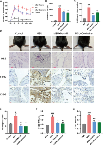 Figure 5 Mast-M alleviates MSU-induced gouty arthritis in C57BL/6 mice. (A and B) Foot paw thickness changes were measured at different times after MSU injection. (C) Edema tissue IL-1β content was detected. (D) After MSU injection for 24h, the foot paws were taken pictures and subjected to HE staining, the F4/80 and LY6G were analyzed by immunochemical staining. (E–G) Densitometric analysis was used to quantify the levels of HE staining, F4/80, and LY6G. Data were expressed as mean ± SEM (n=5). #p<0.05, ###p<0.001 vs Control group; **p<0.01, ***p<0.001 vs MSU group.