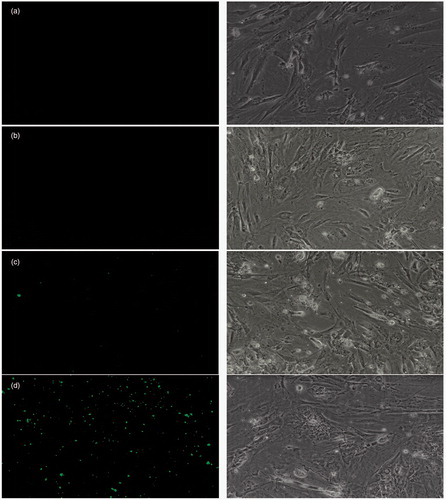 Figure 7. Uptake of fluorescein sodium-loaded formulations by primary neuro-glial cells under fluorescent (left) and phase contrast (right) microscopy. (a) Blank control, (b) Fluorescein sodium solution, (c) Fluorescein sodium-loaded BSA nanoparticles, (d) Glutathione-conjugated fluorescein sodium-loaded BSA nanoparticles.