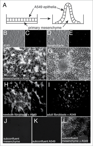 Figure 1. Formation of 3-dimensional structures in epithelial-mesenchymal co-cultures. (A) Diagram of epithelial-mesenchymal co-culture system. (B–E). Images of A549 epithelia and primary mesenchyme cultured alone and imaged by varel optics (B and D) or dark field microscopy (C and E). (F) Dark field image of epithelial-mesenchymal co-culture following three days of co-culture. Bright structures are peaks that rise from the culture dish. (G) Phase contrast image of a 3-dimensional peak with adjacent monolayer of cells. (H and I) Dark field images of co-cultures using newborn lung fibroblasts (H) or adult lung fibroblasts (I). (J–L) Fewer 3-dimensional structures were observed when using subconfluent cultures.