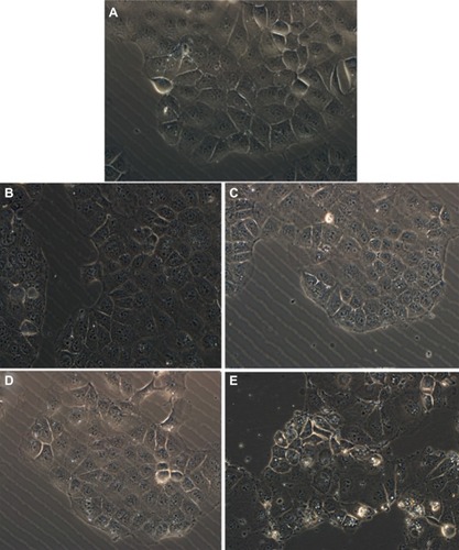 Figure 11 Phase contrast inverted microscope image of Caco-2 cells untreated (control) and treated with various silica carriers at the same concentration. (A) Control, (B) M1, (C) M2, (D) SBA-15, and (E) MCM-41.Abbreviations: M, macroporous; MCM, Mobil Composition of Matter; SBA, Santa Barbara Amorphous.