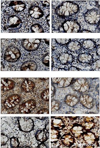 Figure 3 Immunohistochemical results of NPS, NPY, NPY2R and PAR-2 (× 400). (A) NPS in the normal group (× 400); (B) NPS in the IBS-D group (× 400); (C) NPY in the normal group; (D) NPY in the IBS-D group (× 400); (E) NPY2R in the normal group (× 400); (F) NPY2R in the IBS-D group (× 400); (G) PAR-2 in the normal group (× 400); (H) PAR-2 in the IBS-D group (× 400).