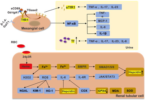 Figure 3. The relationship between iron metabolism, IgAN, and chronic inflammation. β-1,4-GalT, sTfR1, and CD89 are expressed by antibodies on mesangial cells in IgAN. Gd-IgA1 activates inflammation by promoting TfR1 overexpression through positive feedback to promote the secretion of IL-6, TNF-α, IL-1β and MCP-1 by the NF-κB pathway [Citation106–108]. Overexpressed TfR1 can release sTfR1, which positively correlates with TNF-α, IL-17 and IL-23. When the glomerular filtration barrier is disrupted, Tf is increased in the urine. Tf is positively correlated with TNF-α, IL-17, IL-23, IL-6 and CRP. Ferroptosis is present in IgAN, and hemoglobin from hematuria is reabsorbed by 24p3R in renal tubular cells. Due to the tubular toxicity of hemoglobin, Fe3+ produced by the Fenton reaction promotes oxidative stress, causing increased expression of NGAL, KIM-1, HO1 and IL-6. The SMAD/BMP pathway and JAK/STAT3 pathway promote the expression of hepcidin [Citation11,Citation109]. GPX4 and SOD expression was decreased and MDA expression was increased in IgAN. GPX4 can suppress IL-6 by inhibiting LOX. In addition, hepcidin achieves renal protection by inhibiting IL-6 and HO-1 in hemoglobin-mediated renal tubular injury.