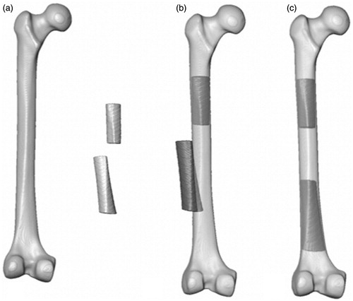 Figure 4. (a) The synthetic atlas, proximal and distal fracture fragments in their scanned positions. (b) The atlas, registered to the proximal fracture fragment, with the inferior fragment in its malaligned position. (c) The proximal fragment, with the registered atlas, and the aligned distal fracture fragment.
