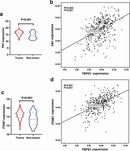 Figure 11. Expression of hub genes in gastric cancer and their correlation with TRPS1 based on the TCGA database. (a) Expression of FN1 in gastric cancer group compared with the non-tumor group; (b) Correlation between FN1 and TRPS1; (c) Expression of ITGB1 in the gastric cancer group compared with the non-tumor group; (d) Correlation between ITGB1 and TRPS1. TCGA, the cancer genome atlas; FN1, fibronectin 1; ITGB1, integrin β1