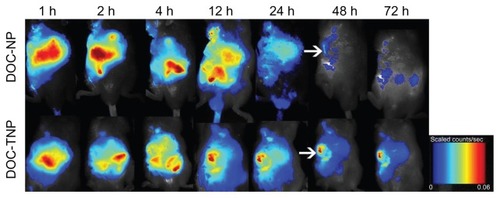 Figure 4 In vivo NIRF images of H22 tumor bearing mice following intravenous administration of NIR-797 labeled DOC-NPs and DOC-TNPs during 72 hours. The tumors were marked by arrows.Abbreviations: DOC-NP, docetaxel-loaded nanoparticle; DOC-TNP, tumor-targeted docetaxel-loaded nanoparticle; NIR, near-infrared; NIRF, near-infrared fluorescent.