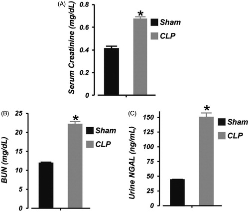 Figure 2. Early polymicrobial sepsis induces acute kidney injury in neonatal pigs. Mean data illustrating: (A) serum concentration of creatinine (LC/MS-MS assay), (B) serum concentration of urea nitrogen (BUN; colorimetric plate assay), and (C) urine concentration of neutrophil gelatinase-associated lipocalin (NGAL; ELISA) in sham-operated (6 h; n = 6) and septic (6 h; n = 7) neonatal pigs. *p < .05 versus Sham.