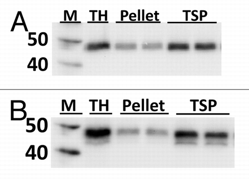 Figure 2. Solubility and expression determination for Pfs25-FhCMB. Western blot analysis of total homogenate (TH), pellet suspended in 1x PBS, and total soluble protein (TSP) with (A) anti-4xHis mAb and (B) anti-LicKM polyclonal antiserum.