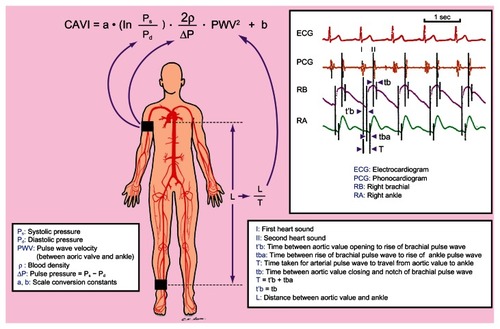 Figure 2 Schematic illustration of the acquisition of study parameters for computation of Cardio-Ankle Vascular Index (CAVI).