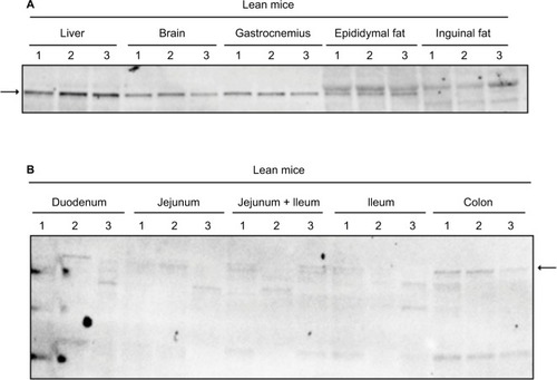 Figure 2 The MetAP2 tissue expression in lean mice.