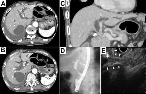 Figure 1 Radiological images.