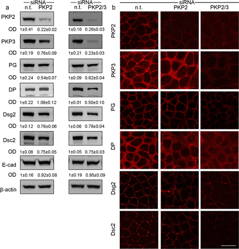Figure 3. Effects of PKP knockdown on desmosomal proteins in Caco2 cells