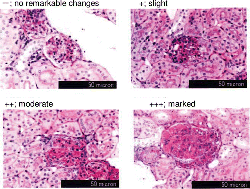 Figure 4.  Effect of KPP intake on increase of kidney mesangial matrix in KK-Ay mice. Kidney was stained with Periodic-Acid Schiff, and 100 glomeruli per mouse were picked up for microscopic evalutaion with grades of no remarkable changes (−), slight changes (+), moderate changes (++), and marked changes (+++).