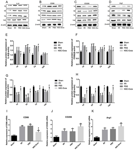 Figure 8 NSC-Exos ameliorated local inflammatory microenvironment in parietal cortex after MCAO. (A–D) IL-6, CD86 (pro-inflammatory factors), and CD206, Arg1 (anti-inflammatory factors) in the infarct area were detected by Western blot. The results were calculated in gray value and displayed as target protein bands and internal reference bands. (A) Western blot analysis of IL-6 (B) Western blot analysis of CD86. (C) Western blot analysis of CD206. (D) Western blot analysis of Arg1. (E–H) The relative protein expression statistics of IL-6, CD86, CD206, and Arg1 in sequence. From the 1d after stroke, the production of IL-6 and CD86 increased significantly. After NSC-Exos treatment, the expression of IL-6 and CD86 was reduced, while the expression of CD206 and Arg1 increased. (I–K) On 3d, mRNA expression of M1/M2 markers was detected by q-PCR. (I) q-PCR analysis of CD86 mRNA level. (J) q-PCR analysis of CD206 mRNA level. (K) q-PCR analysis of Arg1 mRNA level (**P<0.01, *P<0.05 vs Sham group; #P<0.05 vs IRI group; &P<0.05 vs PBS group).