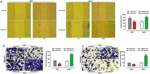 Figure 3. Effects of miR-200b-3p on migration and invasion of GC cells.