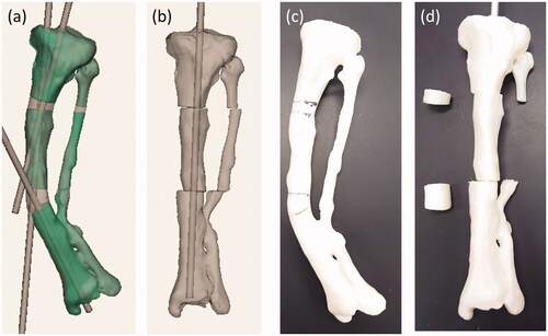 Figure 4. (a) The preoperative 3D model data of the left tibia. (b) The postoperative 3D model data of the left tibia. (c) and (d) are photographs of preoperative and postoperative 3D printed model of the tibia, respectively.