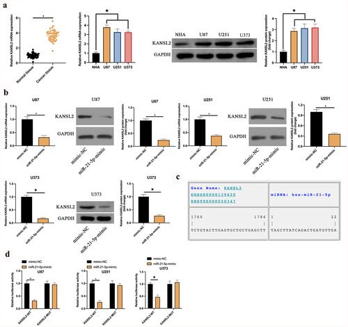 Figure 4. KANSL2 is the target gene of miR-21-5p. A: RT-qPCR and Western blot detection of KANSL2 in tumor tissues, para-cancerous normal tissues, GBM U87, U373, and U251 cells, and human astrocytes NHA; B: RT-qPCR and Western blot test of KANSL2 in U87, U373, and U251 cells after elevating miR-21-5p; C: https://cm.jefferson.edu/ website prediction of the latent-binding sites of miR-21-5p with KANSL2; D: The luciferase activity assay verification of the targeting of miR-21-5p with KANSL2. Manifestation of values was in mean ± SD (N = 3).