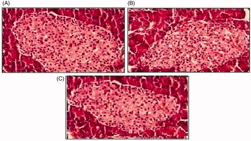 Figure 9. Histological slides of pancreas of rabbit of control group I (A), after oral solution of 5-FU-MMWCH-NPs treated group II (B) and 5-FU-MMWCH-NPs treated group III (C).