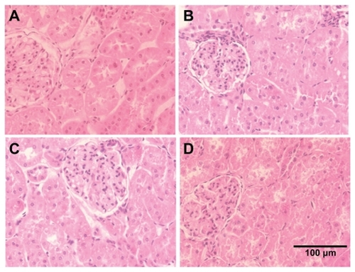 Figure 5 Cerium oxide nanoparticle exposure has no effect on the histological appearance of the kidney. (A) Saline control (400×), (B) CeO2 at 1.0 mg/kg (400×), (C) CeO2 3.5 mg/kg (400×), and (D) CeO2 7.0 mg/kg (400×).
