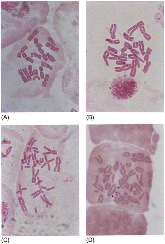 Figure 8. Different number chromosome damage in metaphase cells obtained from the meristem root-type cells of onion (Allium cepa L.): (A) one damaged chromosome; (B) four damaged chromosomes; (C) eight damaged chromosomes; (D) whole chromosome set is damaged.