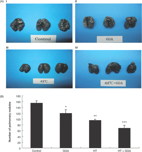 Figure 4. Lung metastatic nodules of each group of pretreated colon26 cells in an experimental lung metastasis model. (A) Macroscopic observation of lung metastatic nodules from untreated, GGA pretreated, hyperthermia pretreated, and GGA plus hyperthermia pretreated groups. (B) Formations of lung nodules by colon26 cells. We counted the metastatic nodules on the lung surface 14 days after cancer cell injection. Data are presented as the mean ± SEM of five mice. *P < 0.05 compared with the control, **P < 0.001 compared with the control, ***P < 0.0001 compared with the control.