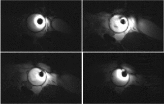 Figure 3. Intravascular imaging (in vivo) using TrueFISP.