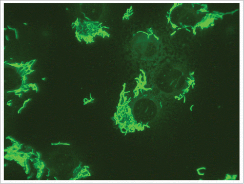 Figure 4. Positive immunofluorescence reaction with Streptobacillus moniliformis ATCC 14647T. Suspended L929 cells are infected, pipetted to glass slides and incubated for 4 hours until complete adherence.