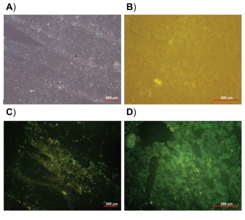 Figure 7 Light image of spleen tissue section (A). Fluorescence images of spleen tissue 24 hours after intravenous injection of: saline (B), pegylated nanoparticles (C), and nonpegylated nanoparticles (D).