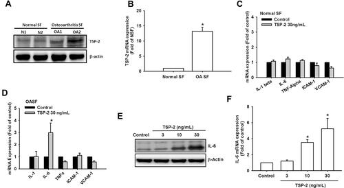 Figure 1 TSP2 is associated with IL-6 expression level in OASFs. (A and B) OASFs obtained from 5 healthy donors and 5 patients with OA were subjected to perform Western blot and qPCR assays for evaluating TSP2 expression level. (C and D) OASFs and normal SFs underwent 24 h of TSP2 incubation. The mRNA expression levels of IL-1β, IL-6, TNF-α, ICAM-1, and VCAM-1 were investigated by qPCR assay (n = 5). (E) OASFs were treated with different doses of TSP2 for 24 h before collection of cell lysates. IL-6 protein levels were determined by Western blot analysis (n = 5). (F) OASFs were treated with different doses of TSP2 for 24 h, followed by determining IL-6 mRNA expression by qPCR (n = 5). Results are expressed as the mean ± S.D. *p < 0.05 compared with untreated controls.