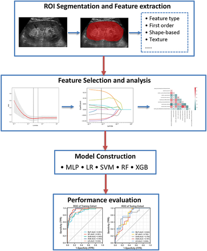 Figure 2 The radiomics flow chart of the study.