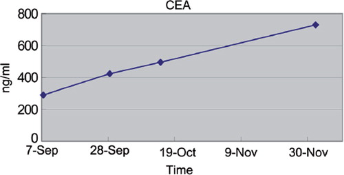 Figure 2. The increase of carcinoembryonic antigen over time.