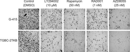 Figure S2 Representative images of the effect of mTOR inhibitors on cell migration. Assays were performed using 24-well Transwell™ plates containing polycarbonate filters with an 8 μm pore size. Before seeding, G-415 and TGBC-2TKB cells were exposed to LY294002 (10 μM), rapamycin (50 nM), RAD001 (1 nM), and AZD8055 (25 nM) for 1 hour. Dimethylsulfoxide (DMSO) 0.1% was used as control. Cells were counted after 24 hours using an optic microscope.Abbreviations: DMSO, dimethyl sulfoxide; mTOR, mammalian target of rapamycin.