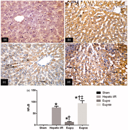 Figure 3. Immunohistochemical detection of NF-κB (p65). Figures shown are representative micrographs for each group. (a) Section showing non-immunoreactivity in sample from the sham group. (b) Strong positive reactivity (arrow) in sample from I/R rat. (c) Mild positive staining (arrow) in sample from Eug10-treated rat. (d) Strong positive staining (arrow) were in Eug100-treated rat sample. (e) The staining when quantified. Data shown in (e) is mean percent NF-κB+ cells among all total hepatic cells counted (±SEM) fromsix rats/gruop. * p < 0.05 vs sham, † p < 0.05 vs I/R. ‡ p < 0.05 versus Eug10. Magnification = 400×.