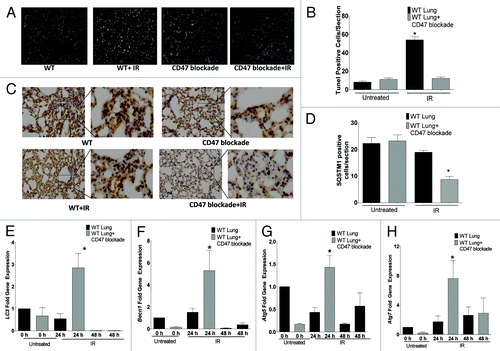 Figure 9. Suppression of CD47 upregulates autophagy and inhibits apoptotic lung tissue cell death in vivo after exposure to total body IR. WT mice were treated with saline or 10 µM CD47 morpholino. After 48 h of treatment, a group of each was exposed to TBI and sacrificed 24 h or 48 h after IR exposure. (A) TUNEL staining of representative sections of lung tissue from mice treated with saline and CD47 morpholino with or without exposure to IR fluorescent nuclei are indicative of apoptotic cells. (B) Quantitative analysis of TUNEL positive nuclei in lung tissue from control and morpholino-treated mice. (C) Immunohistochemical analysis and quantification (D) of SQSTM1 expression in lung tissue of control and irradiated mice treated with CD47 morpholino. Measurement of mRNA levels of LC3 (E) Becn1 (F), Atg5 (G), and Atg7 (H) in lung tissue of mice exposed to total body irradiation after 24 h otherwise noted at 48 h (n = 3, *p < 0.05).