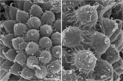 Fig. 2 Tenuibiotus voronkovi: details of the eggshell, shown for the first time with scanning electron microscopy (scale bar in micrometres).