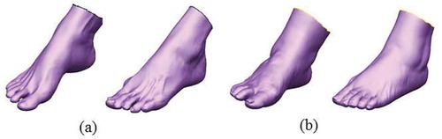 Figure 2. The 3D mesh of the STL file for the feet of (a) patient no. 1 and (b) patient no. 2.