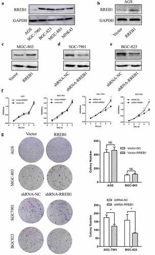 Figure 2. Knockdown of RREB1 inhibit gastric cancer cell proliferation