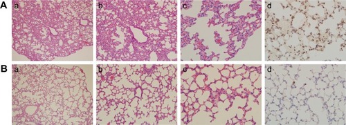 Figure 3 Histological observation (Aa–c and Ba–c) and immunohistochemical staining (Ad and Bd) of macrophage surface molecular marker F4/80 in pulmonary tissues sections.Notes: (A) Experimental group (35 mg/kg dosage group); (B) control group (saline-treated group). Magnifications: (a) 100×; (b) 200×; (c, d) 400×.