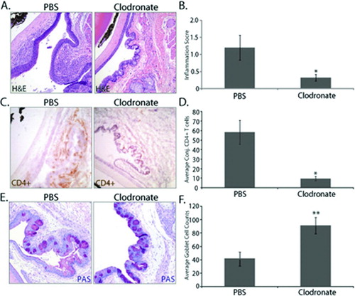 FIGURE 5.  Antigen-presenting cell depletion in mice exposed to desiccating stress attenuating the generation of autoreactive CD4+ T cells and blocking the ability to adoptively transfer T-cell-mediated disease to nude-recipient mice. CD4+ T cells were isolated from the CLN of clodronate- or PBS-treated mice exposed to DS and adoptively transferred to nude-recipient mice to determine if the absence of a full repertoire of APCs within the ocular surface tissues inhibits generation of ocular surface-specific autoreactive CD4+ T cells. (A) H&E staining showed a (B) significant decrease in overall inflammatory cell infiltration within the ocular surface tissues of nude recipients of CD4+ T cells from clodronate-treated donor mice compared to PBS controls (3 days postadoptive transfer). Furthermore, (C) IHC confirmed that CD4+ T cells isolated from clodronate-treated donor mice did not readily accumulate within the conjunctiva as there was only trace CD4+ staining, which accounted for a (D) significant decrease in CD4+ T cells and (E, F) protection from the loss of PAS-positive goblet cells. (A) H&E staining; (B) overall inflammatory score ± SEM (scale 0–3); (C) CD4+ T cell staining in the conjunctiva; (D) is average conjunctival (conj.) CD4+ T-cell counts ± SEM; (E) PAS+ goblet cell staining in the conjunctiva; (F) is average conjunctival goblet cell counts ± SEM. The data are representative of three independent experiments, with an n = 5–6 mice/group. Statistically significant values (*p ≤ 0.05, **p ≤ 0.01) are indicated relative to nude recipients of CD4+ T cells from PBS liposome-treated mice. Reproduced from Schaumburg et al. 2011. J Immunol. 187[Citation7]:3653–3662 [Citation59].