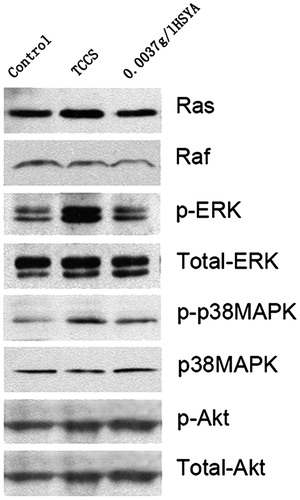 Figure 5. Expression level of related molecules in the ERK pathway of HUVECs. Of the three protein band patterns on each gel, the control group (left), tumour cell culture supernatant-induced group (middle) and the HSYA-treated group (right) are shown.