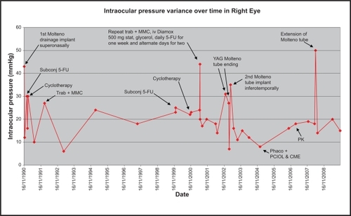 Figure 1 Graph showing IOP (mm Hg) variance over time in the right eye with points of intervention when there was a spike in IOP.