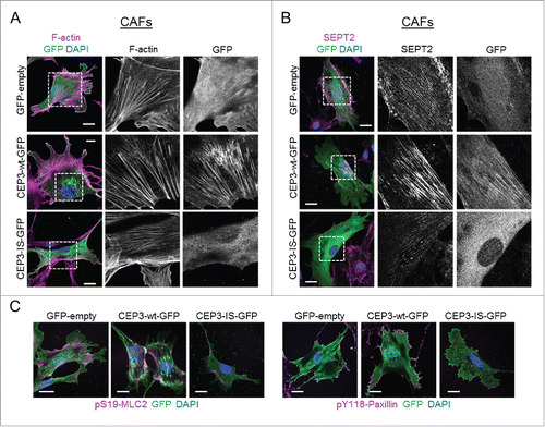 Figure 3. A Cdc42-defective binding mutant of Cdc42EP3 acts as a dominant-negative when expressed in cancer-associated fibroblasts (CAFs). (A) Panels show GFP (green), F-actin (magenta) and DAPI (blue) staining of cancer-associated fibroblasts (CAFs) following transfection with GFP or GFP-tagged wild-type (wt) or IS mutant (IS) Cdc42EP3 (CEP3) proteins. The grayscale panels show individual channel magnifications of perinuclear areas. Scale bars, 25 μm. (B) Panels show GFP (green), SEPT2 (magenta) and DAPI (blue) staining of CAFs following transfection with GFP or GFP-tagged wild-type (wt) or IS mutant (IS) Cdc42EP3 (CEP3) proteins. The grayscale panels show individual channel magnifications of perinuclear areas. Scale bars, 25 μm. (C) Left panels show images of GFP (green), pS19-MLC2 (magenta) and DAPI (blue) staining of CAFs following transfection with GFP or GFP-tagged wild-type (wt) or IS mutant (IS) Cdc42EP3 (CEP3) proteins. Right panels show GFP (green), pY118-Paxillin (magenta) and DAPI (blue) staining of CAFs following transfection with GFP or GFP-tagged wild-type (wt) or IS mutant (IS) Cdc42EP3 (CEP3) proteins. Scale bars represent 25 μm.