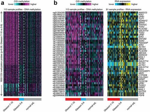 Figure 3. Hierarchical clustering analysis of 1655 CGI probes across all AA prostate tissue samples categorized by Gleason score 7–10 (grade 2–5) tumours, Gleason score 5–6 (grade 1) tumours and normal (benign) prostate tissues. a. Clustering analysis of the top 1655 CGI differential methylation that are significant (p < 0.05) by t-test and methylation change greater than 5%) and separated into Gleason 7–10; Gleason 5–6; and benign prostate tissues. b. Comparison of the significant differential DNA methylation and mRNA expression as categorized by Gleason score and normal tissues.