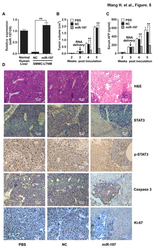 Figure 5. miR-197 suppresses HCC growth in vivo. (A) qRT-PCR analysis of miR-197 expression in normal human liver tissue, or SMMC-LTNM tumor tissue two weeks after intratumoral injection of cholesterol-conjugated miR-197 mimics (miR-197) or negative control (NC). (B–C) Two weeks after subcutaneous inoculation of SMMC-LTNM tumor cells, HCC-bearing nude mice were treated by intratumoral injection of cholesterol-conjugated miR-197, NC or PBS. Tumor volume (B), serum AFP levels (C) were shown as indicated in (C). (D) H&E staining and detection of STAT3, p-STAT3, Caspase 3 and Ki-67 by IHC in HCC tissues was performed two weeks after intratumoral injection of cholesterol-conjugated miR-197, NC or PBS. Scale bars, 50 μm. Data are shown as mean ± s.d. (n = 3) of one representative experiment. Similar results were obtained in three independent experiments. %%p < 0.01.