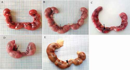 Figure 1. Photographs of the uteri of pregnant albino rats secluded at 20th day of gestation. (A) Control group showing uterus with normal distribution of fetuses in both horns. (B, C) LD group, (D, E) HD group. Uterine bleeding (arrow), dead fetuses (lines), resorbed fetus (head arrow). F = fetus, Pl = placenta, V = vagina