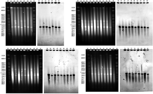 Figure 4 S1-PFGE pattern for ST11 isolates and Southern blot analysis of blaKPC-2 genes PFGE result of S1 digested plasmid DNA of ST11 isolates and the corresponding Southern hybridization using the blaKPC-2 specific probe. M, Salmonella serotype Braenderup strain H9812 was digested by XbaI.