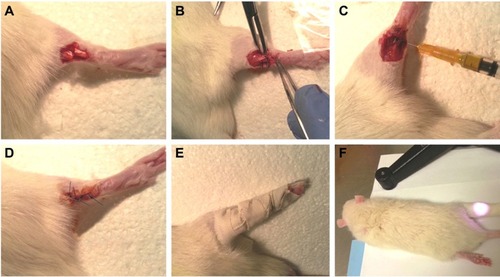 Figure 1 Representative surgical procedure of TRR and laser exposure.Notes: (A) The peritendon transaction to create a rupture. (B) The Achilles tendon was sutured back. (C) Injection of GNRs-1/curc@PMs solution. (D and E) The incision was stitched, and the lag was splinted by plastic plates. (F) NIR exposure.Abbreviations: TRR, tendon rupture and repair; NIR, near-infrared.