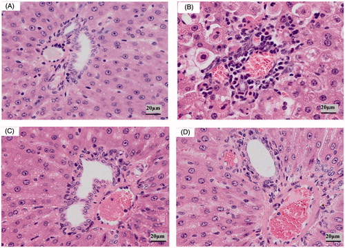 Figure 5. Liver pathological changes (HE × 100) of rat in different groups. Note: (A) control group, (B) model group, (C) VOAS group and (D) Dex group.
