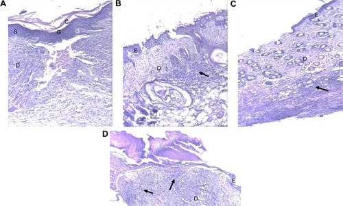 Figure 9 Light microscopy images of representative skin samples (stained with hematoxylin and eosin) (×400) after 15 d of treatment: (A) 0.1% AgNPs hydrogel-treated group; (B) 1% silver sulfadiazine cream-treated group; (C) blank hydrogel-treated group; and (D) control group (untreated mice). Arrows refer to lymphocytes. C, G, S, D, and E represent stratum corneum, stratum granulosum, stratum spinosum, dermis, and epidermis, respectively.Abbreviation: AgNPs, silver nanoparticles.