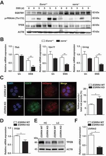 Figure 3. Esrra deficiency leads to defective autophagic flux in colonic tissues and epithelial cells. (A) Expression of SQSTM1, phospho-PRKAA/AMPKα, TFEB and ACTB in colon tissue from untreated and DSS-induced Esrra+/+ and esrra−/− mice by western blot analysis (B) The relative mRNA expressions of Tfeb, Vps11 and Uvrag in intestinal epithelial cells (IECs) of mice detected by qPCR at 0 and 5 days of DSS treatment. (C) Representative images and quantitative analysis for ESRRA WT and KO HT-29 cells transduced with retroviruses expressing a tandem-tagged mCherry-EGFP-LC3B. (D, E) qPCR and western blot analysis of TFEB in ESRRA WT and KO HT-29 cells respectively. (HC, High confluent and LC, Low confluent cell). (F) mRNA levels of UVRAG in ESRRA WT and KO HT-29 cells. *P < 0.05, **P < 0.01, ***P < 0.001. Two-way ANOVA (B) or Mann-Whitney U test (C, D, and F). Data are the representative of three independent experiments (A and C left), and values represent means (± SEM) from three or four independent experiments performed in triplicate (B, C right, D, F). Un, Untreated. DSS, DSS treated